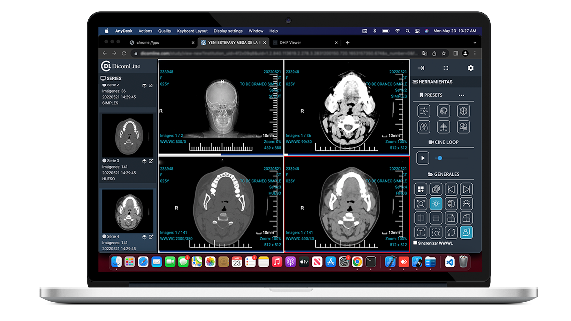 DICOM Viewer Demo
